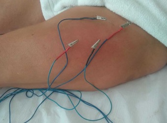 Eletroacupuntura com laser.