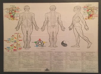 Quadro de pontos do corpo