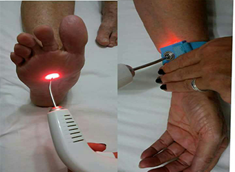 Laser Terapia