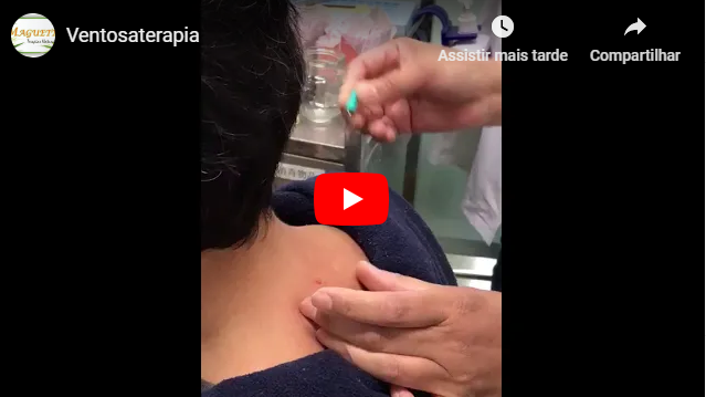 Ventosa Terapia - Maguetta Terapias Naturais